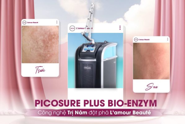 PICO+BIO: Công nghệ trị nám đột phá L'AMOUR BEAUTÉ