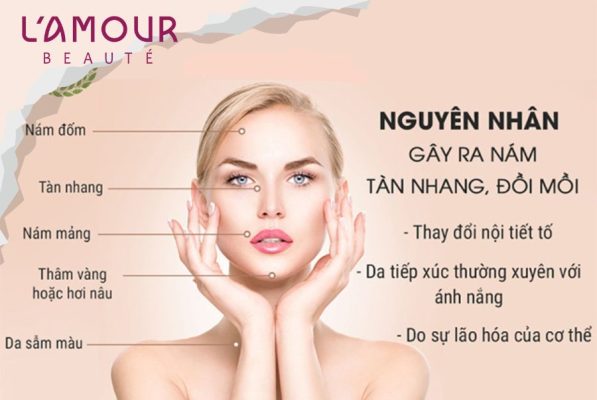 Nguyên nhân gây nám da ở phái nữ