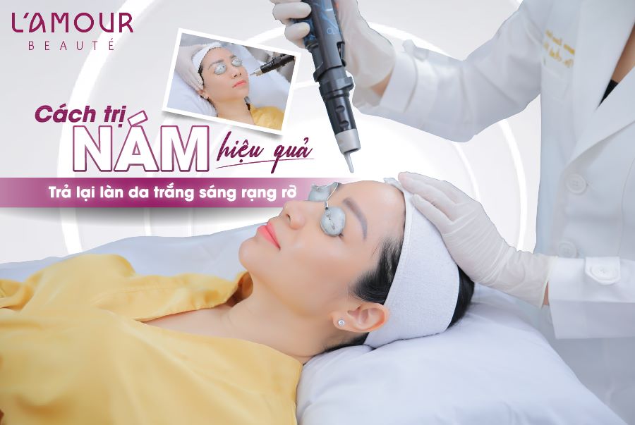 Cách trị nám tàn nhang lâu năm hiệu quả, an toàn