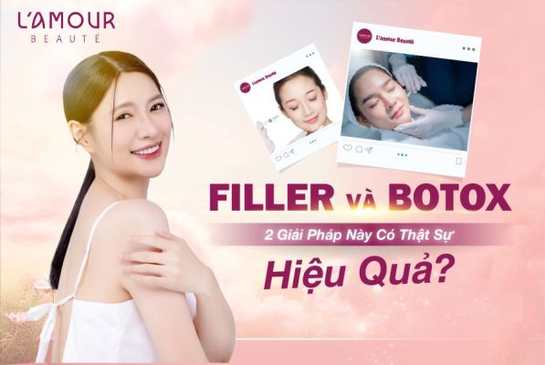 Filler và Botox: 2 Giải Pháp Này Có Thật Sự Hiệu Quả?