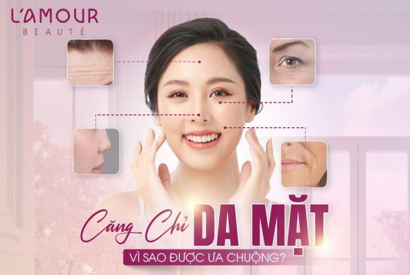 Căng Chỉ Da Mặt: Vì Sao Được Ưa Chuộng?