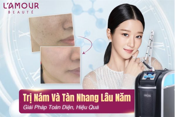 Trị Nám, Tàn Nhang Lâu Năm: Giải Pháp Toàn Diện, hiệu quả