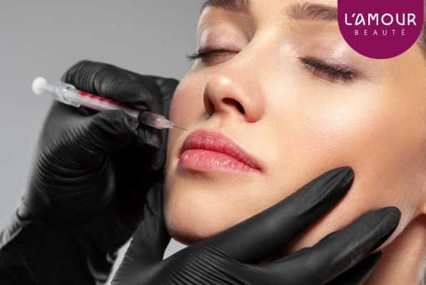 Tiêm Botox Rãnh Cười Là Gì Mà Được Ưa Chuộng Như Vậy?