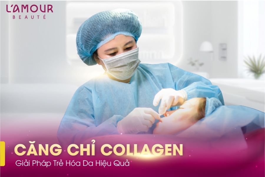 Căng Chỉ Collagen Là Gì?