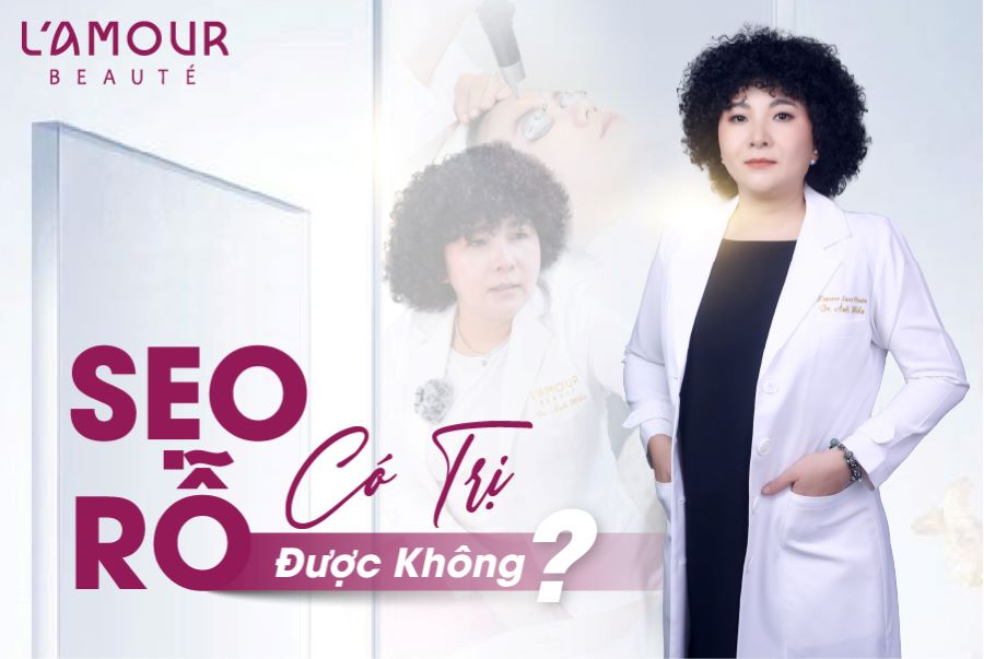 Mặt rỗ điều trị hết được không?