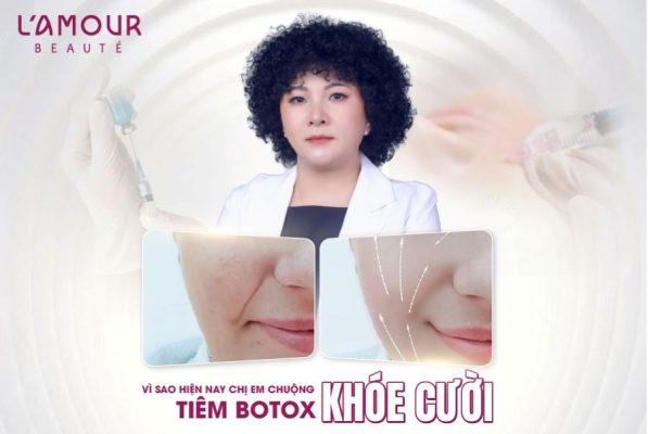 Top 8 Lý Do Tiêm Botox Rãnh Cười Được Ưa Chuộng!