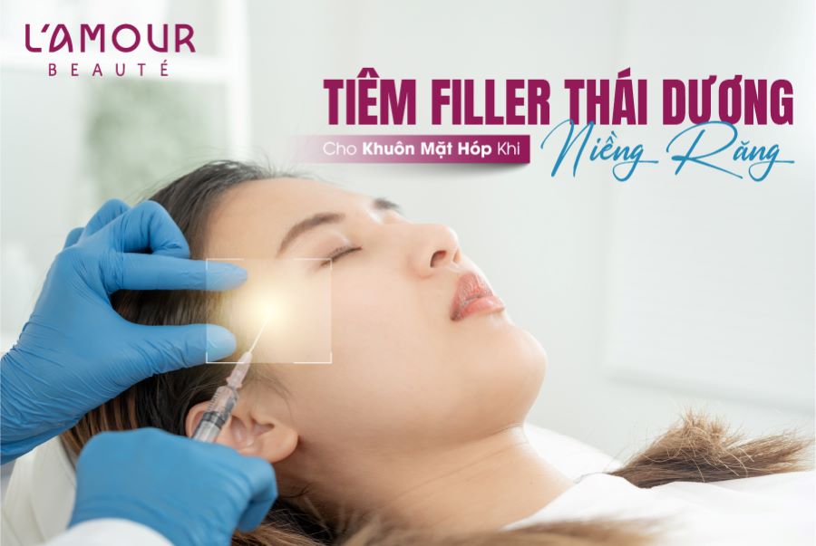 Tiêm Thái Dương Mặt Bị Hóp Khi Niềng Răng