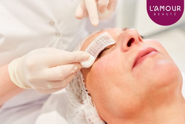 Thermage FLX mắt là gì? 