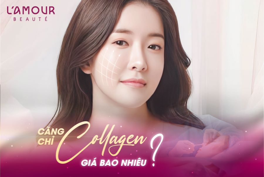 Căng Chỉ Collagen Là Gì?